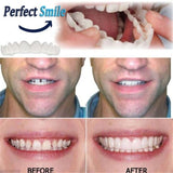 👨‍⚕Adjustable Snap-On Dentures (Upper & Lower Teeth/Set)😁